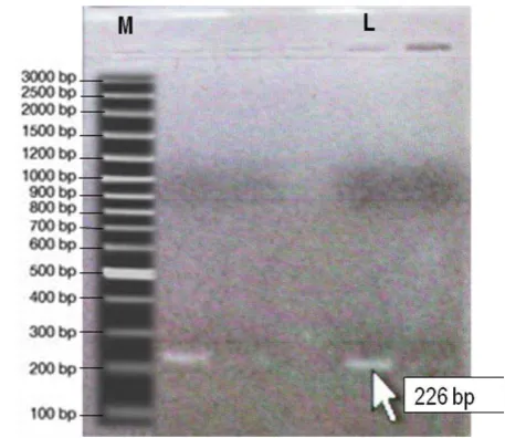 Gambar 1. Profil elektroforesis hasil PCR Gen Glutation S Transferase (Sj26GST) sampel cacing S