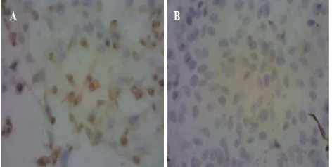 Gambar 3.Persentase sel vero hidup setelah pem-berian kurkumin dan PGV-0