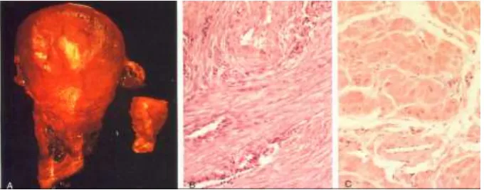 Gambar B adalah foto mikroskopik dari irisan uterus normal, sel uterus berbentuk 