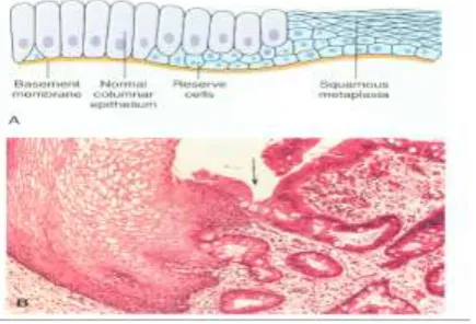 Gambar A dan B menunjukkan sel epitel yang 