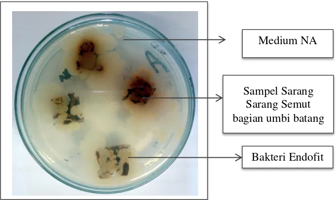 Gambar 4.1 Hasil Isolasi Bakteri Endofit Tanaman sarang  semut (Myrmecodia pendens) 