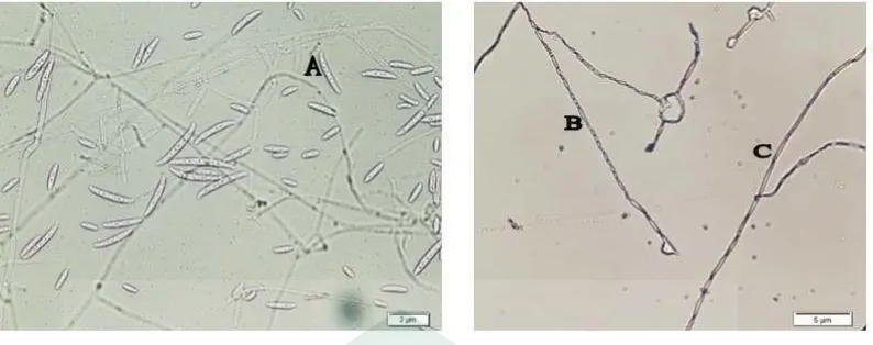 Gambar 2.7.  Mikroskopis F. moniliforme (Perbesaran 400x). A. Makrokonidia, B. Mikrokonidia, C
