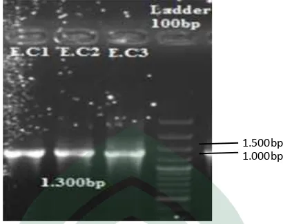 Gambar 5.1 Hasil elektroforesis dari produk amplifikasi gen 16S-rRNA