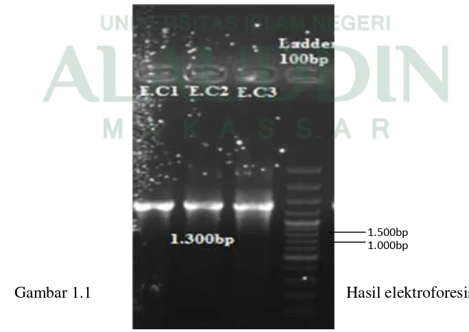 Gambar 1.1Hasil elektroforesis dari