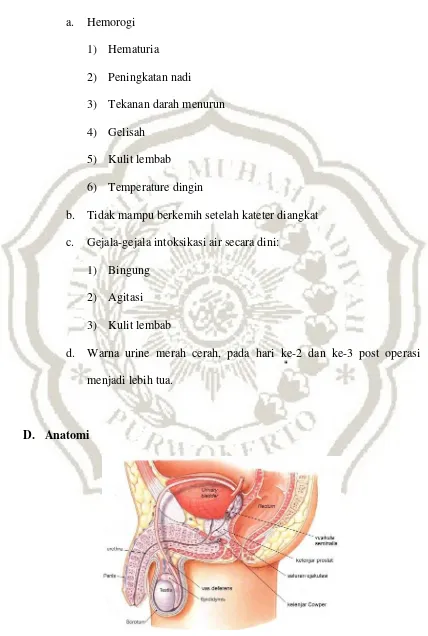 Gambar 2.1. Anatomi prostat 