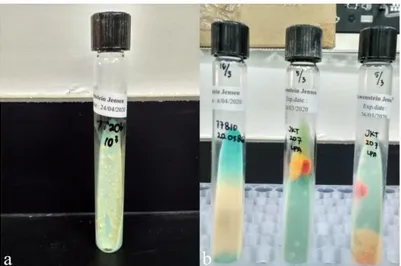 Gambar 1. Medium LJ yang tidak terkontaminasi (a) dan terkontaminasi (b) 
