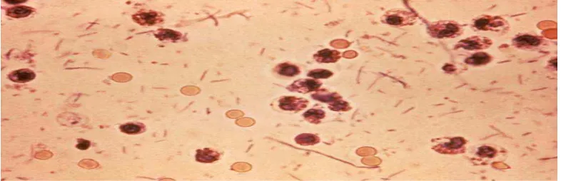 Gambar 2.3 Bakteri Shigella dysentriae (Hale, T.L and Keusch, G.T. 1996) 