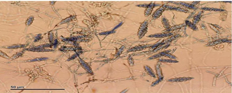 Gambar 2.5 Jamur Microsporum gypseum(Currah, R. 1985) 