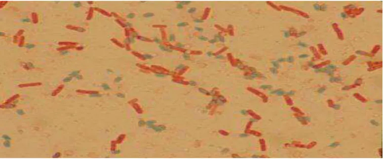 Gambar 2.2 Bakteri Bacillus cereus ( Kotiranta A, et al. 2000) 