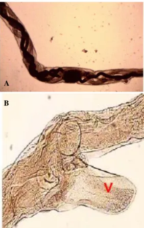 Gambar 2. Uterus  dan  ovarium  berwana  putih  di  sekitar  usus  yang  berisi  darah  dan  berpilin  (A)  vulva  flap  (V)  pada  ujung  posterior H