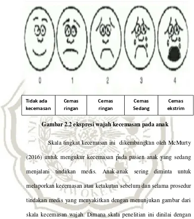 Gambar 2.2 ekspresi wajah kecemasan pada anak 