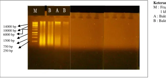 Gambar 1. Hasil Elektroforesis Ekstraksi DNA Total 