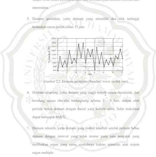 Gambar 2.2. Demam quotidian (Sumber: www.scribd.com) 