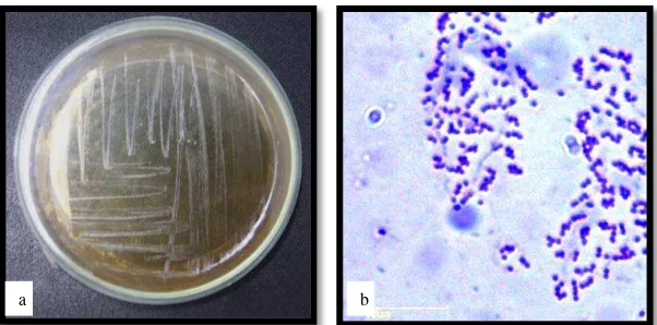Gambar 4. Streptococcus agalactiae (a) Makroskopis (b) Mikroskopis  
