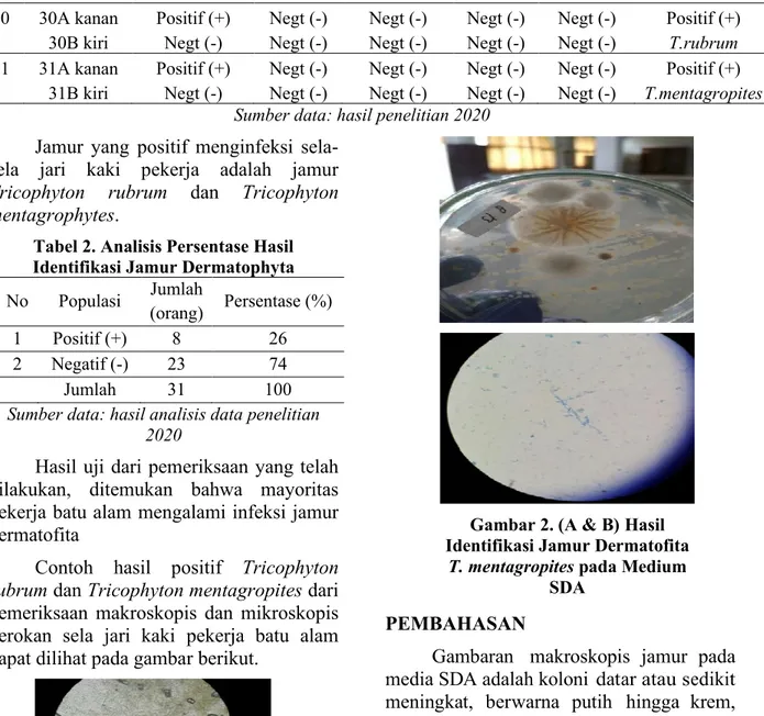 Tabel 2. Analisis Persentase Hasil  Identifikasi Jamur Dermatophyta  No  Populasi  Jumlah 