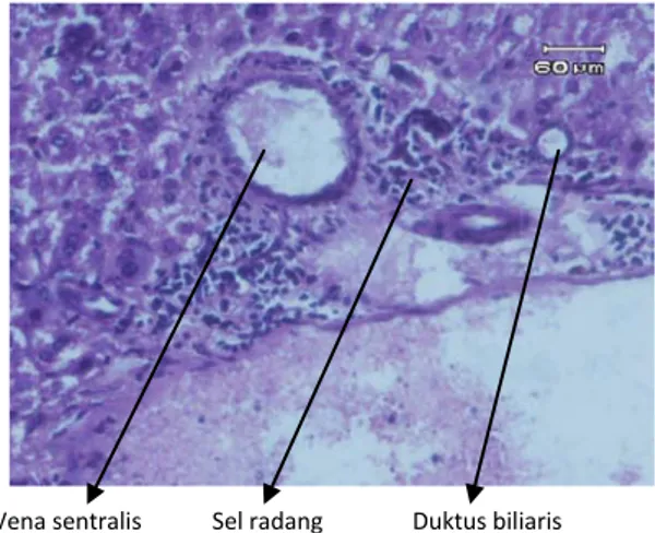 Gambar  1. Struktur hati normal pada tikus kontrol  (kelompok A) pembesaran 100-200 x