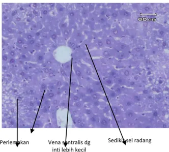 Gambar 7.  Kelompok D2 sel-sel hati  umumnya  sudah regenerasi, maturisasi  lebih banyak  (kurang  sel besar), kongesti berkurang