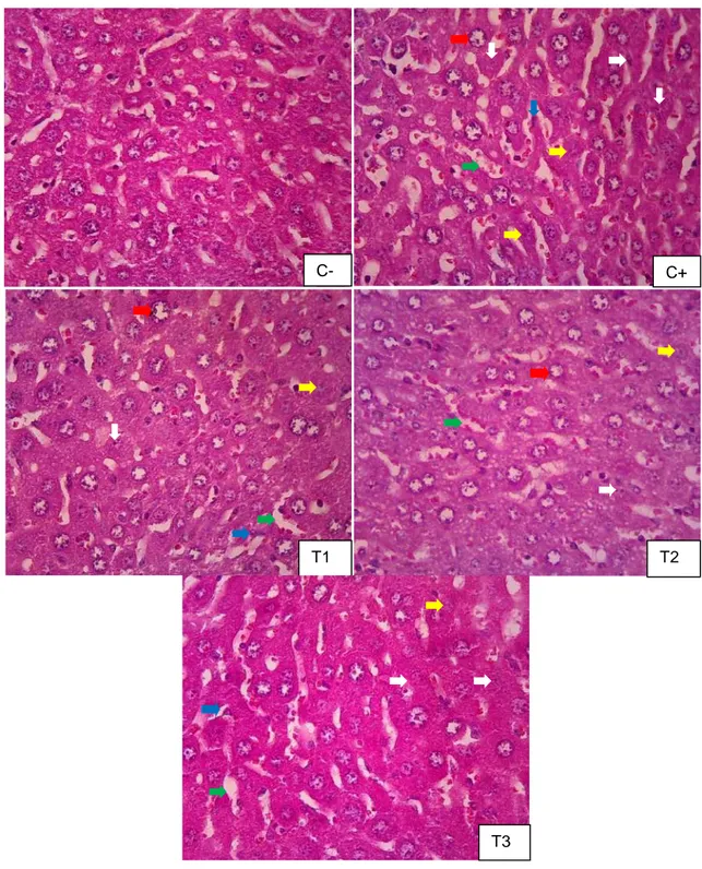 Figure 1 Histopathological features of intralobules liver. Pictures taken using Olympus® CX- CX-21  Microscope  400x  magnification
