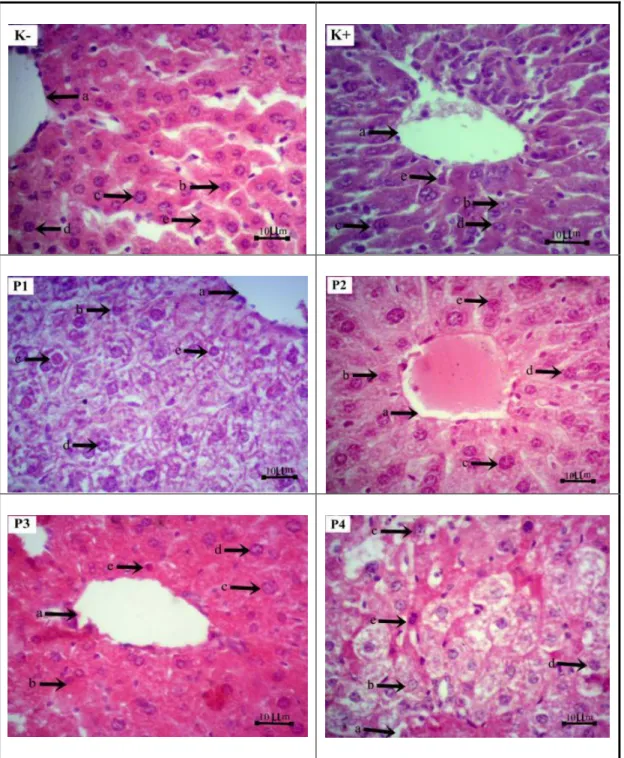Gambar 2. Histologis Hepar Mencit (Mus musculus L.) dengan Pewarnaan HE dan Perbesaran 400X  Keterangan :  a    =  vena sentralis 