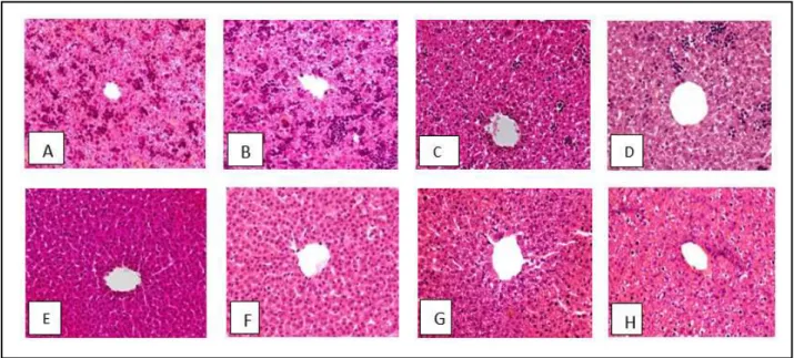 Gambar 1. Gambaran histopatologi Organ Hati Anak Mencit (A) Kontrol negatif  usia ke-0, Sel hepatosit belum teratur, vena  sentralis belum utuh, banyak sel hamatopoesis, (B) Kelompok perlakuan usia ke-0, Sel hepatosit belum teratur, vena sentralis belum  u