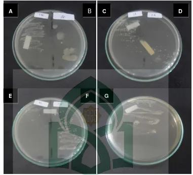 Gambar 3. Foto hasil pengujian skrining antimikroba fraksi larut n-heksan bawang merah 