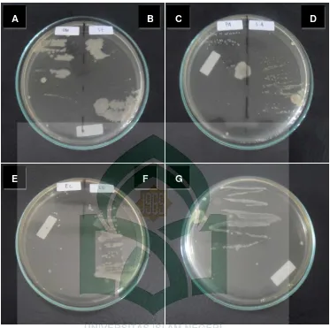 Gambar 4. Foto hasil pengujian skrining antimikroba fraksi tidak larut n-heksan bawang 
