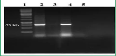 Figure 1: PCR detection of chilli leaf curl virus by coat Protein gene amplification Position of sample 