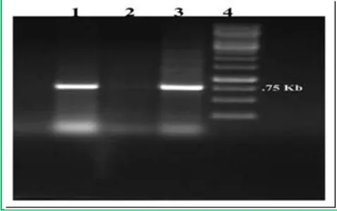 Table 3: Effect of auxin (IBA) along with 2.0% activated charcoal on root induction from shoots of Capsicum annuum after 4 weeks of culture