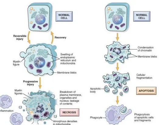 Gambar 2. Perbedaan gambaran sel yang mengalami apoptosis dan nekrosis