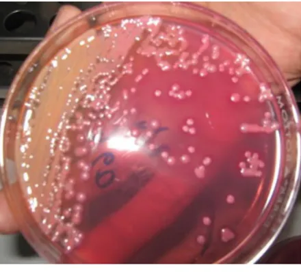 Gambar 1. 4Mac Conkey agar plate yang ditumbuhi bakteri. 