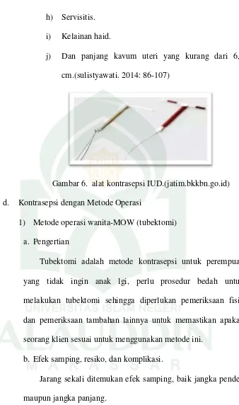 Gambar 6.  alat kontrasepsi IUD.(jatim.bkkbn.go.id) 