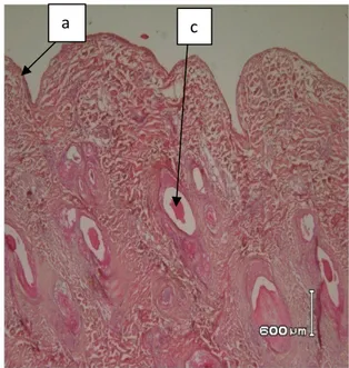 Gambar 3.  Fotomikrograf penampang melintang kulit domba proses unhairing menggunakan enzim  protease Aspergillus sp