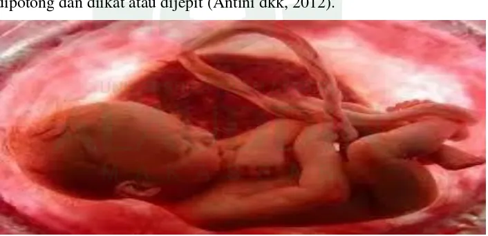 Gambar 1.1. Bayi dan tali pusat dalam Rahim ibu  Sumber: Ria Riksani, 2012 