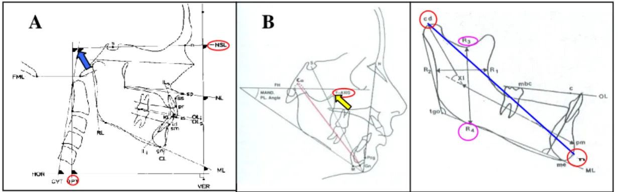 Gambar 1. A. Pengukuran sudut postur kepala, cranio-cervical (NSL/OPT) B. Pengukuran tumbuh kembang       mandibula (dikutip dari Solow dan Tallgren, Kerr, dkk dan Jacobson) 18,15,16 