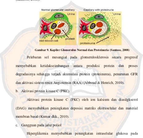Gambar 9. Kapiler Glomerulus Normal dan Proteinuria (Santoso, 2008) 
