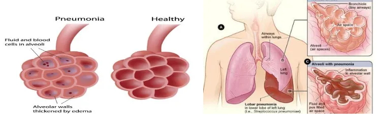 Gambar 2.1. Struktur Sistem Respirasi (Nurarif & Kusuma, 2013) 