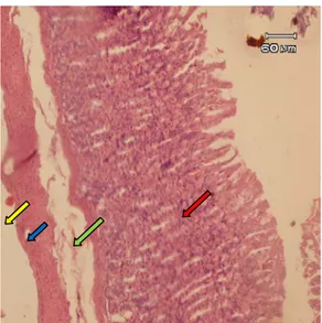 Gambar 3. Gambaran mikroskopik lambung  tikus wistar yang diberi aspirin selama 10 hari