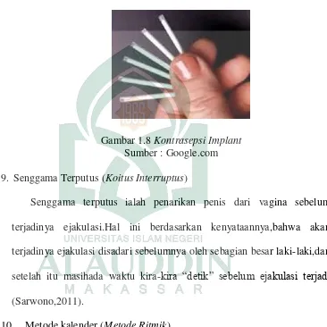 Gambar 1.8 Kontrasepsi Implant 