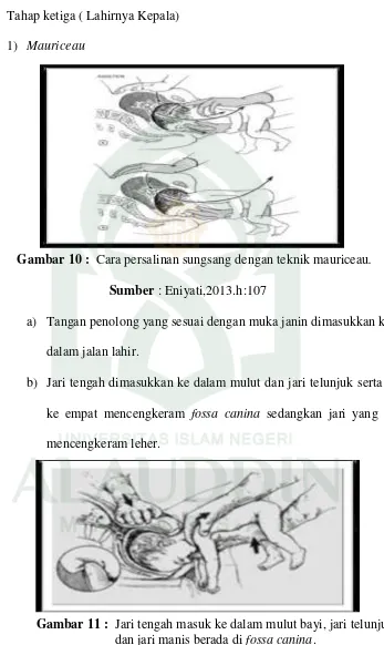 Gambar 11 :  Jari tengah masuk ke dalam mulut bayi, jari telunjuk dan jari manis berada di fossa canina