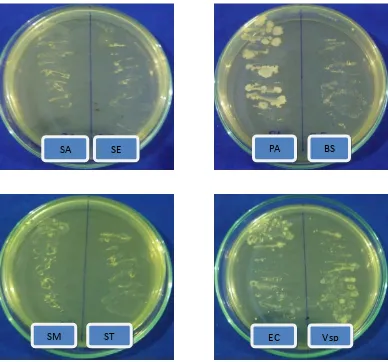 Gambar. 2 : Foto hasil pengujian skrining ekstrak metanol larut heksan    daun    kembang telang (Clitoria ternatea L.) 
