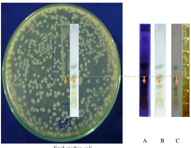 Gambar. 6 : Foto hasil pengujian KLT-Bioautografi ekstrak metanol larut heksan    daun    kembang telang (Clitoria ternatea L.) terhadap bakteri uji Escherichia coli dengan cairan pengelusi n-heksan : etil asetat (5:1)