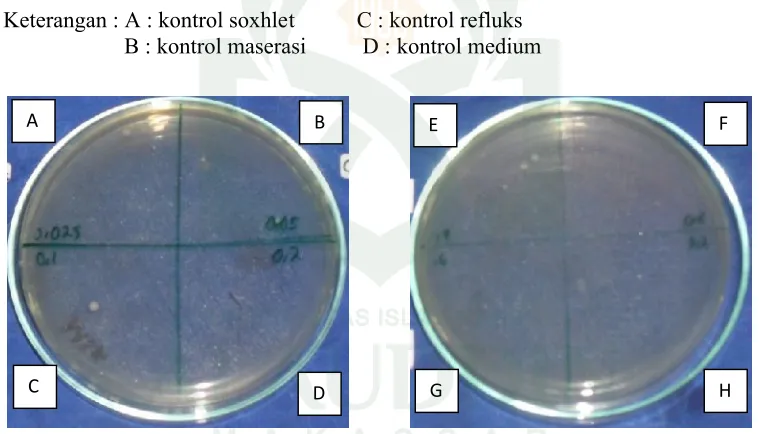 Gambar 13. Foto Hasil Kontrol Konsentrasi Bunuh Minimum (KBM) Ekstrak Metanol Daun Mimba(Azadirachta indica Juss) dengan Beberapa Metode Ekstraksi Terhadap  Bakteri Escherichi coli.