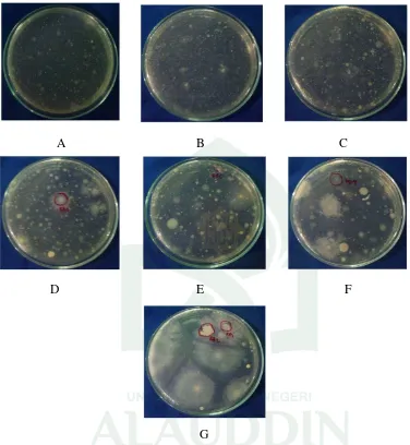 Gambar  2. Foto Hasil Isolat Bakteri dari Air Kanal pada Media Agar 