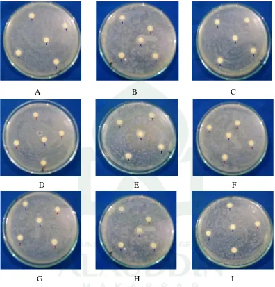 Gambar 8. Foto Hasil Pengujian Penghambatan Fermentat Isolat Bakteri terhadap Keterangan : Mikroba Uji              
