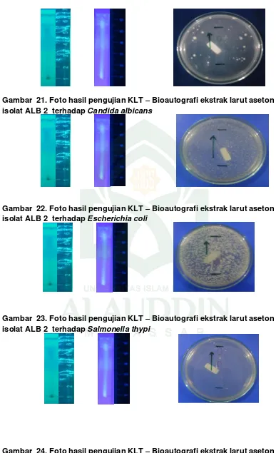 Gambar  24. Foto hasil pengujian KLT –isolat ALB 2  terhadap  Bioautografi ekstrak larut aseton Staphylocccus aureus 