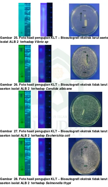 Gambar  28. Foto hasil pengujian KLT –aseton isolat ALB 2  terhadap  Bioautografi ekstrak tidak larut Salmonella thypi 