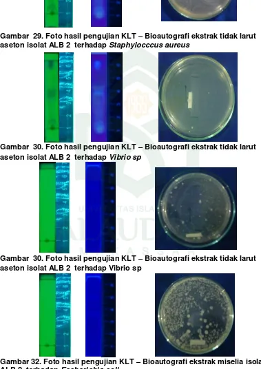 Gambar  29. Foto hasil pengujian KLT – Bioautografi ekstrak tidak larut 