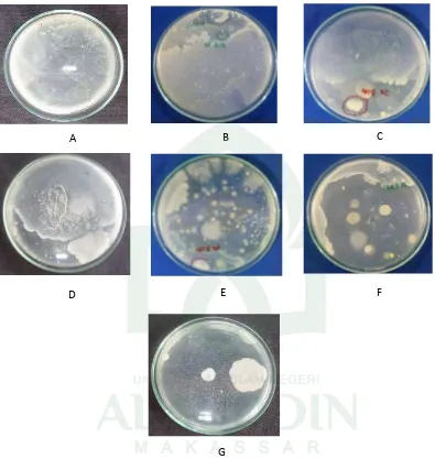Gambar  1. FotoKeterangan :  Hasil Isolat Bakteri dari Air laut  pada Media Agar -1 