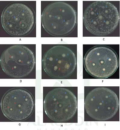 Gambar 8. Foto Hasil Pengujian Penghambatan Fermentat Isolat Jamur terhadap         Mikroba Uji        Keterangan