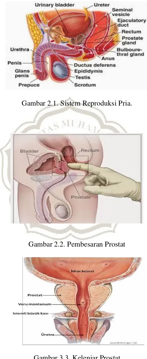 Gambar 3.3. Kelenjar Prostat 